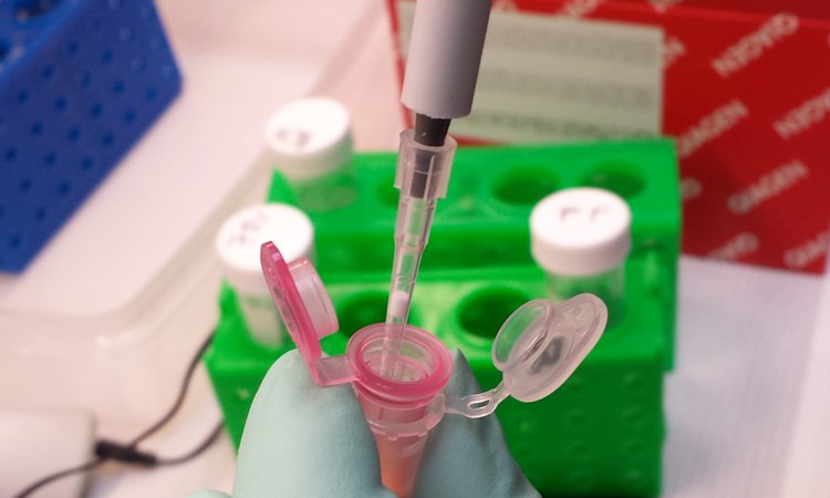 Labwork - extraction Labwork - extraction