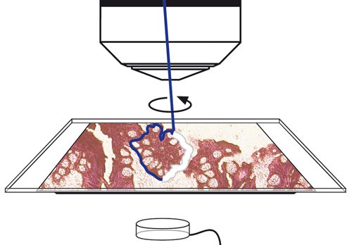 Step 2: Laser beam precisely steered by prisms along your definition